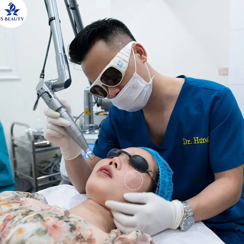 Bắn laser nám chân sâu mấy lần? Thời gian bắn nám là bao lâu