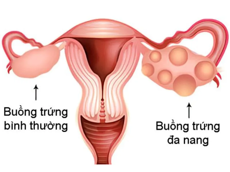 Có nên triệt lông mặt không? Những điều cần lưu ý sau khi triệt