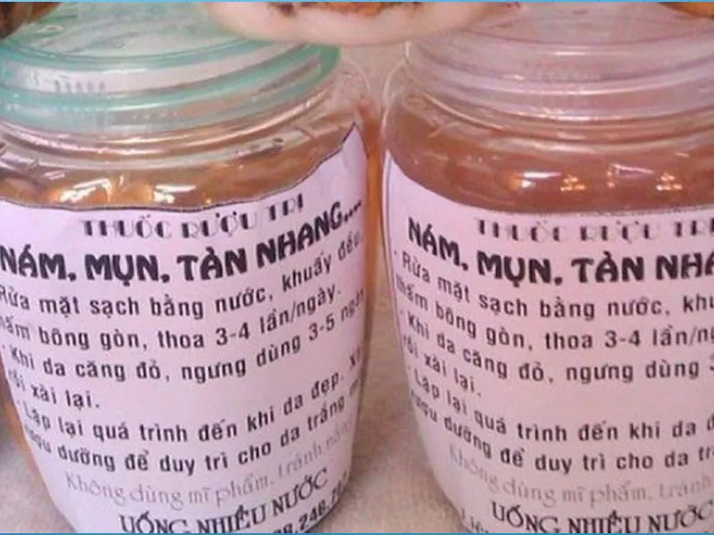 Dùng thuốc rượu trị mụn có tốt không? Có làm hỏng da mặt?