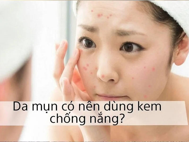 [GIẢI ĐÁP] Da mụn có nên dùng kem chống nắng hay không?