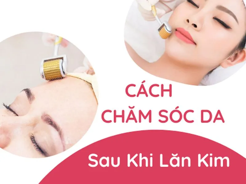 Lăn kim trị mụn có đau không? Có để lại sẹo thâm không?