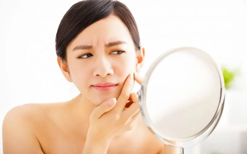 [MÁCH BẠN] Các bước skincare trị mụn đầu đen cực hiệu quả