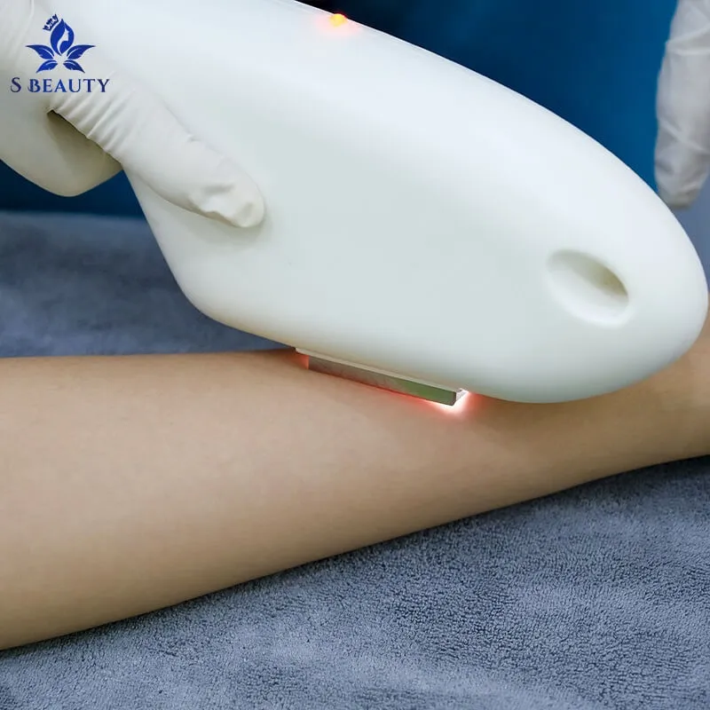 Những ưu và nhược điểm của công nghệ triệt lông IPL 