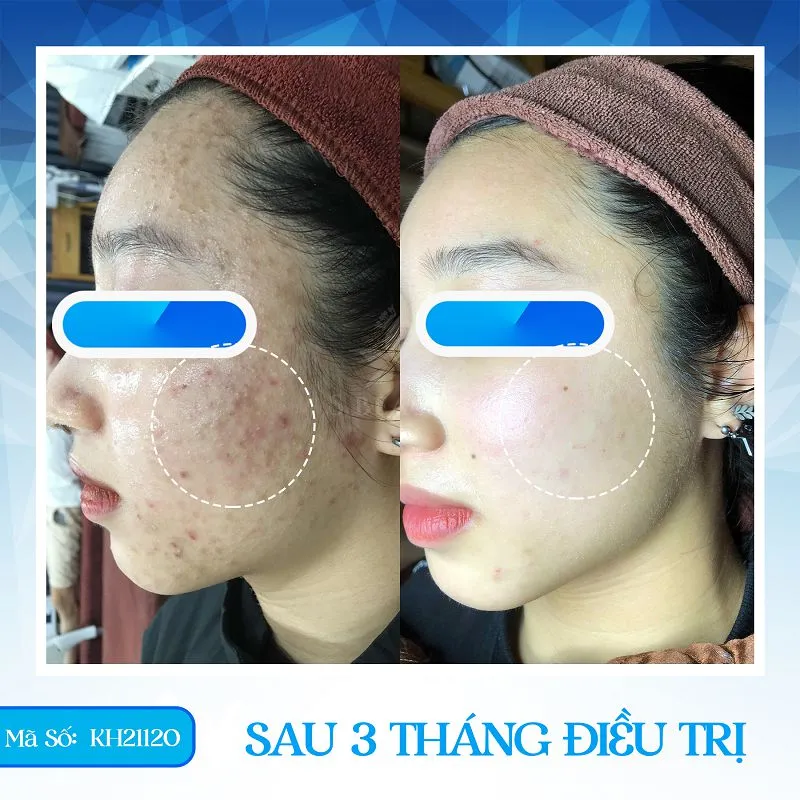 Phốt Phòng khám Da liễu S Beauty – Sự thật đằng sau như thế nào?