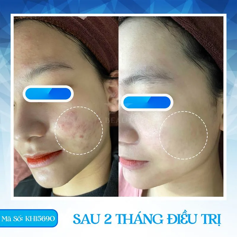 Phốt Phòng khám Da liễu S Beauty – Sự thật đằng sau như thế nào?