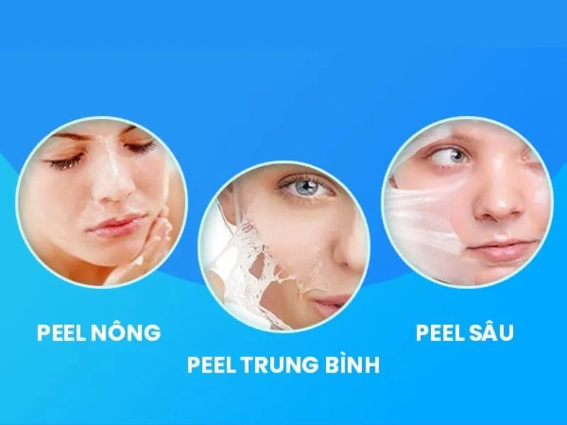 Phương pháp peel da là gì? Có tác dụng như thế nào đối với làn da