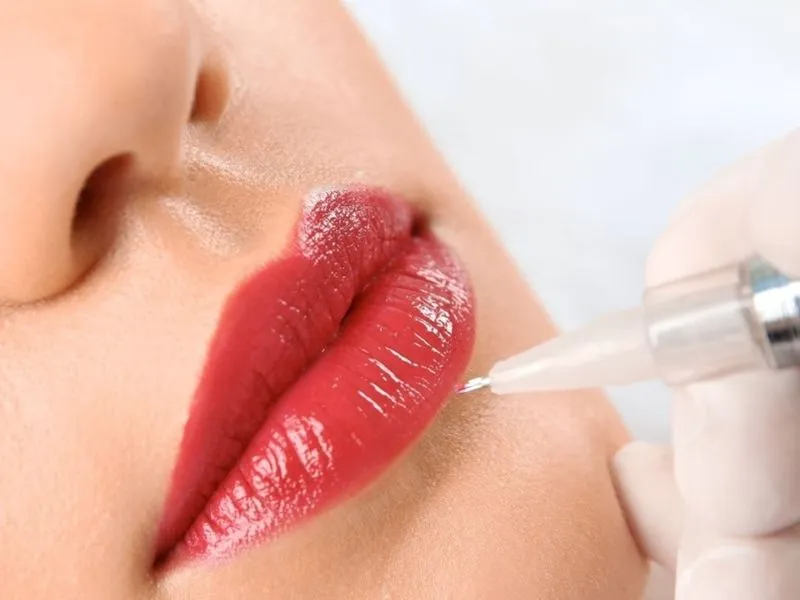 Tiêm filler môi bị nổi mụn là do đâu? Cách khắc phục ra sao?