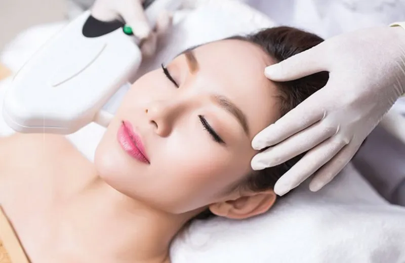 Triệt lông mặt bằng laser. Lưu ý khi triệt lông mặt bằng laser