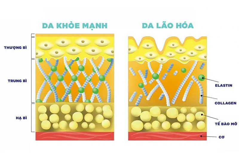 Uống collagen có trị sẹo rỗ không? [Giải đáp từ bác sĩ chuyên khoa]